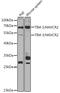 Hepatitis A Virus Cellular Receptor 2 antibody, GTX65883, GeneTex, Western Blot image 