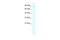 Glutamate Ionotropic Receptor Kainate Type Subunit 2 antibody, 28-273, ProSci, Western Blot image 