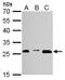 Proteasome Subunit Alpha 3 antibody, LS-C186309, Lifespan Biosciences, Western Blot image 