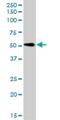 Reticulon 2 antibody, H00006253-D01P, Novus Biologicals, Western Blot image 