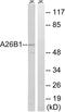 POTE ankyrin domain family member B antibody, LS-C198579, Lifespan Biosciences, Western Blot image 