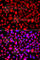 ALG1 Chitobiosyldiphosphodolichol Beta-Mannosyltransferase antibody, A7818, ABclonal Technology, Immunofluorescence image 