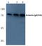 DNA Cross-Link Repair 1C antibody, A02405S516, Boster Biological Technology, Western Blot image 