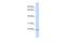 Zinc Finger AN1-Type Containing 5 antibody, A11963, Boster Biological Technology, Western Blot image 