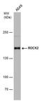 Rho Associated Coiled-Coil Containing Protein Kinase 2 antibody, MA5-27805, Invitrogen Antibodies, Western Blot image 
