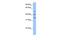 Zinc Finger CCCH-Type Containing 14 antibody, GTX45443, GeneTex, Western Blot image 