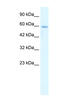 Hematopoietic Cell-Specific Lyn Substrate 1 antibody, 27-444, ProSci, Western Blot image 