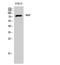 N-Ethylmaleimide Sensitive Factor, Vesicle Fusing ATPase antibody, STJ94560, St John