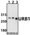 URB1 Ribosome Biogenesis Homolog antibody, A14378-1, Boster Biological Technology, Western Blot image 