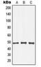 Inhibitor Of Nuclear Factor Kappa B Kinase Subunit Beta antibody, MBS820905, MyBioSource, Western Blot image 