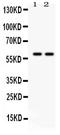 Tyrosine Hydroxylase antibody, PB9449, Boster Biological Technology, Western Blot image 