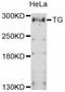 Thyroglobulin antibody, abx126692, Abbexa, Western Blot image 