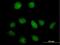 6-Phosphofructo-2-Kinase/Fructose-2,6-Biphosphatase 1 antibody, H00005209-B01P, Novus Biologicals, Immunocytochemistry image 