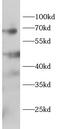 TNF Receptor Associated Factor 5 antibody, FNab10075, FineTest, Western Blot image 