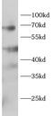 RING finger protein 84 antibody, FNab10075, FineTest, Western Blot image 