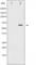 LIM Domain Kinase 1 antibody, abx011922, Abbexa, Western Blot image 