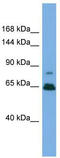 Zinc Finger Protein 676 antibody, TA344454, Origene, Western Blot image 