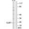 Gap Junction Protein Beta 7 antibody, A15126, Boster Biological Technology, Western Blot image 