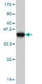 NBR1 Autophagy Cargo Receptor antibody, ab55474, Abcam, Western Blot image 