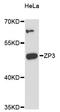 Zona Pellucida Glycoprotein 3 antibody, LS-C748214, Lifespan Biosciences, Western Blot image 