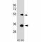 Autophagy Related 5 antibody, F46218-0.4ML, NSJ Bioreagents, Western Blot image 