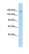 Lysine Demethylase 6A antibody, orb324477, Biorbyt, Western Blot image 