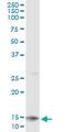 Colipase antibody, LS-C196936, Lifespan Biosciences, Immunoprecipitation image 