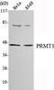 Protein Arginine Methyltransferase 1 antibody, STJ98540, St John