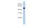 Potassium Voltage-Gated Channel Subfamily J Member 12 antibody, PA5-68685, Invitrogen Antibodies, Western Blot image 