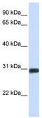 BARX Homeobox 2 antibody, TA343418, Origene, Western Blot image 