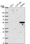 Sprouty Related EVH1 Domain Containing 1 antibody, NBP2-57368, Novus Biologicals, Western Blot image 