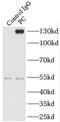 Pyruvate Carboxylase antibody, FNab06981, FineTest, Immunoprecipitation image 
