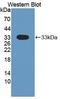 Dual Serine/Threonine And Tyrosine Protein Kinase antibody, LS-C373474, Lifespan Biosciences, Western Blot image 