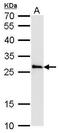 Catechol-O-Methyltransferase antibody, GTX101233, GeneTex, Western Blot image 