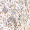 SRSF Protein Kinase 1 antibody, A5854, ABclonal Technology, Immunohistochemistry paraffin image 
