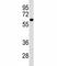 Phosphatidylinositol Glycan Anchor Biosynthesis Class S antibody, F46302-0.4ML, NSJ Bioreagents, Western Blot image 