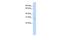 Exosome Component 7 antibody, GTX47313, GeneTex, Western Blot image 