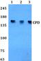 Carboxypeptidase D antibody, PA5-75825, Invitrogen Antibodies, Western Blot image 