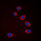 Mitogen-Activated Protein Kinase Kinase Kinase 8 antibody, LS-C358799, Lifespan Biosciences, Immunofluorescence image 
