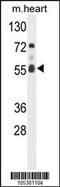 Fas-activated serine/threonine kinase antibody, 62-647, ProSci, Western Blot image 