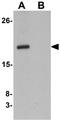 CXXC Finger Protein 4 antibody, GTX84996, GeneTex, Western Blot image 
