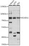 Acyl-CoA Dehydrogenase Family Member 11 antibody, A10875, Boster Biological Technology, Western Blot image 