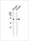 Phosphatidylinositol-5-Phosphate 4-Kinase Type 2 Gamma antibody, PA5-72180, Invitrogen Antibodies, Western Blot image 