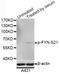 FYN Proto-Oncogene, Src Family Tyrosine Kinase antibody, AP0510, ABclonal Technology, Western Blot image 