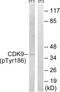 Cyclin Dependent Kinase 9 antibody, LS-C198788, Lifespan Biosciences, Western Blot image 