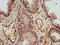 SHANK Associated RH Domain Interactor antibody, LS-C672258, Lifespan Biosciences, Immunohistochemistry paraffin image 