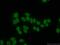 Transketolase antibody, 66016-1-Ig, Proteintech Group, Immunofluorescence image 