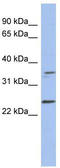 Necdin, MAGE Family Member antibody, TA337667, Origene, Western Blot image 