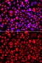 ALG1 Chitobiosyldiphosphodolichol Beta-Mannosyltransferase antibody, GTX64746, GeneTex, Immunocytochemistry image 