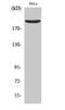 Reticulon 4 antibody, STJ94527, St John